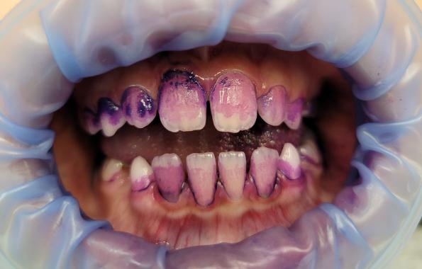 Foto před zákrokem