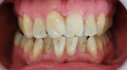 Foto před zákrokem