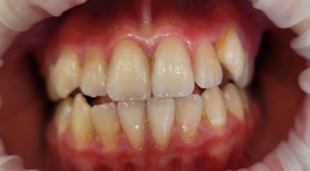 Foto před zákrokem